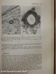 Pathology of Pulmonary Hypertension