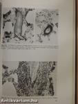 Pathology of Pulmonary Hypertension