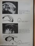 Atlas der Allgemeinen Ultraschalltomographie