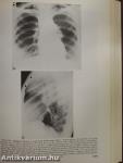 Diagnosis of Diseases of the Chest II. (töredék)