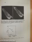 Functional Aspects of the Normal, Hypertrophied, and Failing Heart