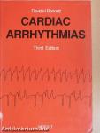 Cardiac Arrhythmias