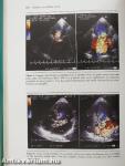 Advances in Echo Imaging Using Contrast Enhancement