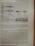 From auscultation to phonocardiography
