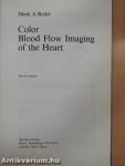 Color Blood Flow Imaging of the Hearth