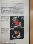 Color Blood Flow Imaging of the Hearth