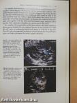 Color Blood Flow Imaging of the Hearth