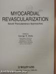 Myocardial revascularization