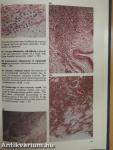 A Colour Atlas of Cardiac Pathology