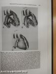 A Textbook of Cardioplegia for Difficult Clinical Problems