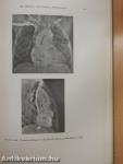 Congenital Malformations of the Heart I.