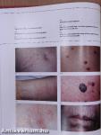 The Nurse's Atlas of Dermatology