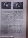 The L. M. Ericsson Review 1933 Nr. 4