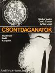 Csontdaganatok