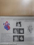 A szívhibák atlasza