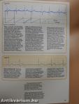 Understanding the Electrocardiogram 3