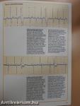 Understanding the Electrocardiogram 3