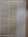 Understanding the Electrocardiogram 1.