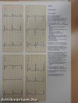 Understanding the Electrocardiogram 1.