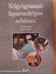 Nőgyógyászati laparoszkópos sebészet
