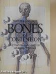 Bones of Contention