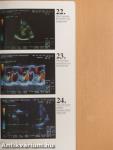 A színkódolt doppler echocardiographia atlasza