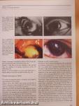 European Journal of Ophthalmology July-August 2008