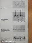 EKG a sürgősségi ellátásban