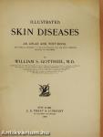 Illustrated skin diseases