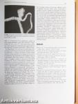 Vascularis neurologia