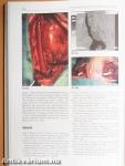 Vascularis neurologia