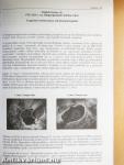 Gastro Update 2004