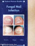 Fungal Nail Infection