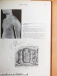 Congenital Deformities of the Chest Wall and Their Operative Correction