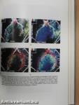 Clinical Applications of Cardiac Digital Angiography