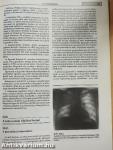 Pulmonológia
