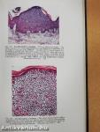 Atlas of Histopathology of the Skin