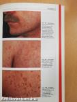 Dermatologie und Venerologie