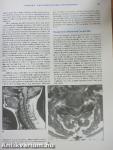 Principles of Neurology