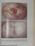 Hypothalamic Control of the Anterior Pituitary