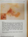 Kompendium zur Differentialdiagnose pigmentierter/Hautveränderungen mit Hilfe des Dermatoskops