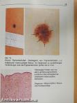Kompendium zur Differentialdiagnose pigmentierter/Hautveränderungen mit Hilfe des Dermatoskops