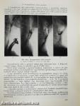 Orr-, fül-, gégészeti röntgendiagnosztika 