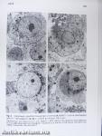 Extremely Low Frequency Electromagnetic Fields: The Question of Cancer
