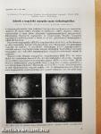 Szemészet 1990. február