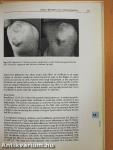 A Handbook of Hyperlipidaemia
