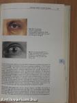 A Handbook of Hyperlipidaemia