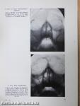 Orr-, fül-, gégészeti röntgendiagnosztika 