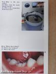 Diagnostic Picture Tests in Dentistry