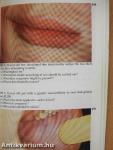 Diagnostic Picture Tests in Oral Medicine